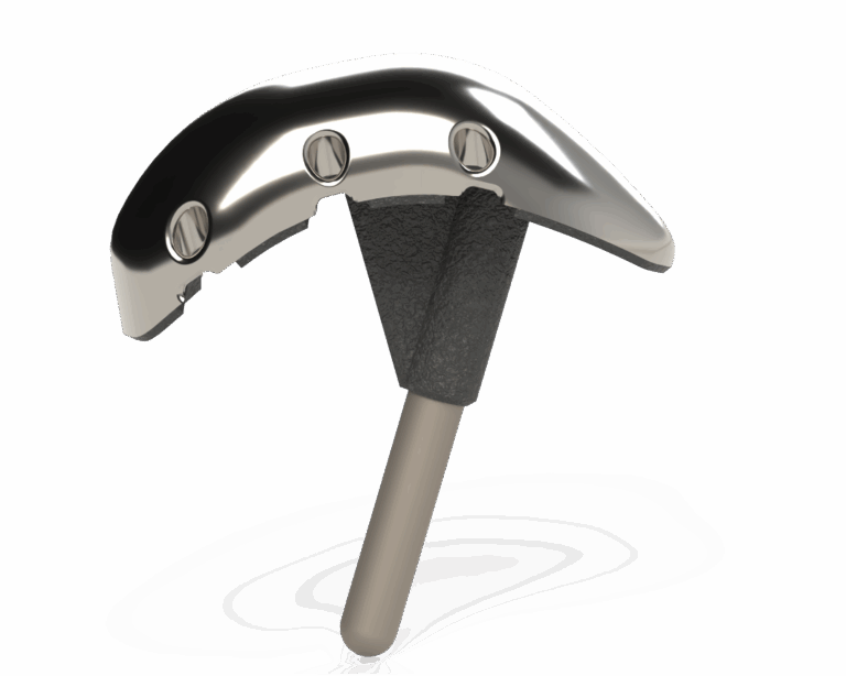 Filling the Gap in Rotator Cuff Tear Treatment - Capitan Orthopedics